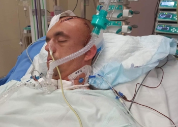 Ogromna tragedia dotknęła rodzinę z Leszna. Potrzebują pomocy