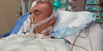 Ogromna tragedia dotknęła rodzinę z Leszna. Potrzebują pomocy