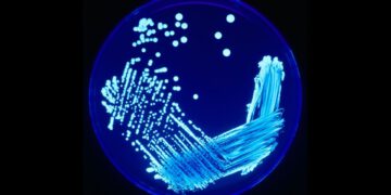 legionella